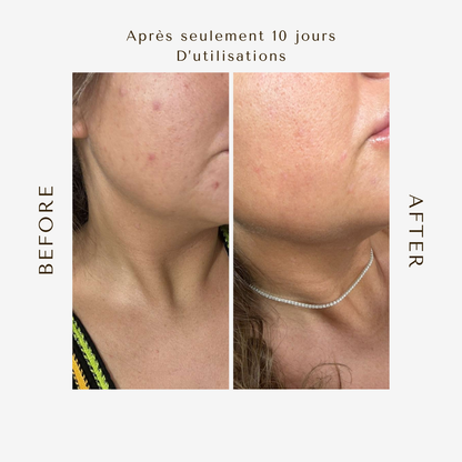 Sérum Pro-Vitamine A Végétale – Peaux Sensibles, Mixtes, Déshydratées 50ML