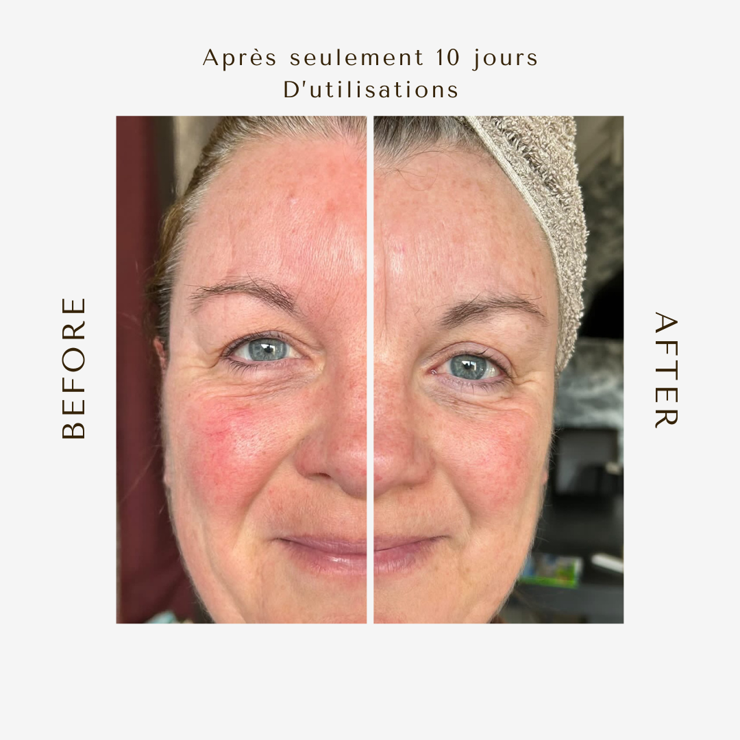 Sérum Pro-Vitamine A Végétale – Peaux Sensibles, Mixtes, Déshydratées 50ML