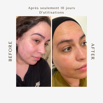 Sérum Pro-Vitamine A Végétale – Peaux Sensibles, Mixtes, Déshydratées 50ML