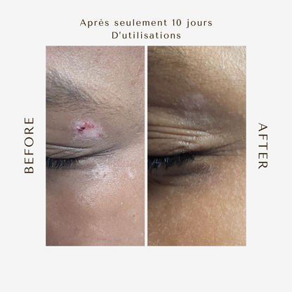 Sérum Pro-Vitamine A Végétale – Peaux Sensibles, Mixtes, Déshydratées 50ML